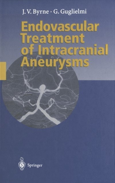Guido Guglielmi, James Byrne - Endovascular Treatment of Intracranial Aneurysms, E-bok