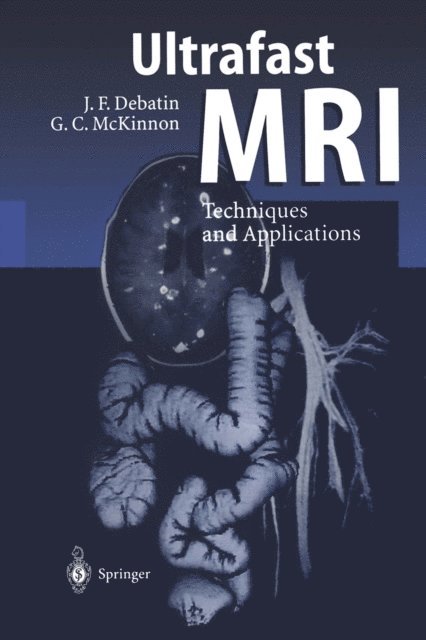 Graeme C. McKinnon, Jorg F. Debatin - Ultrafast MRI, E-bok