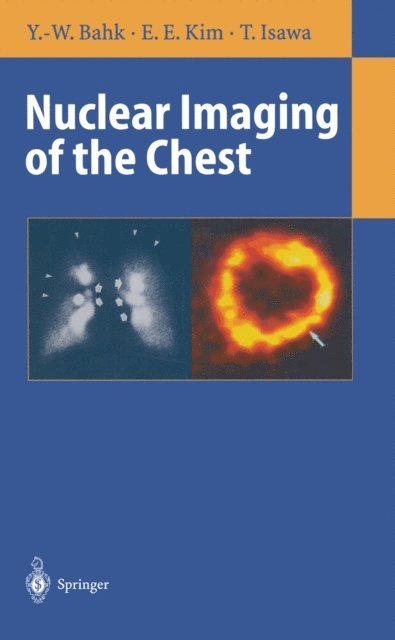 Toyoharu Isawa, E.Edmund Kim, Yong-Whee Bahk - Nuclear Imaging of the Chest, E-bok