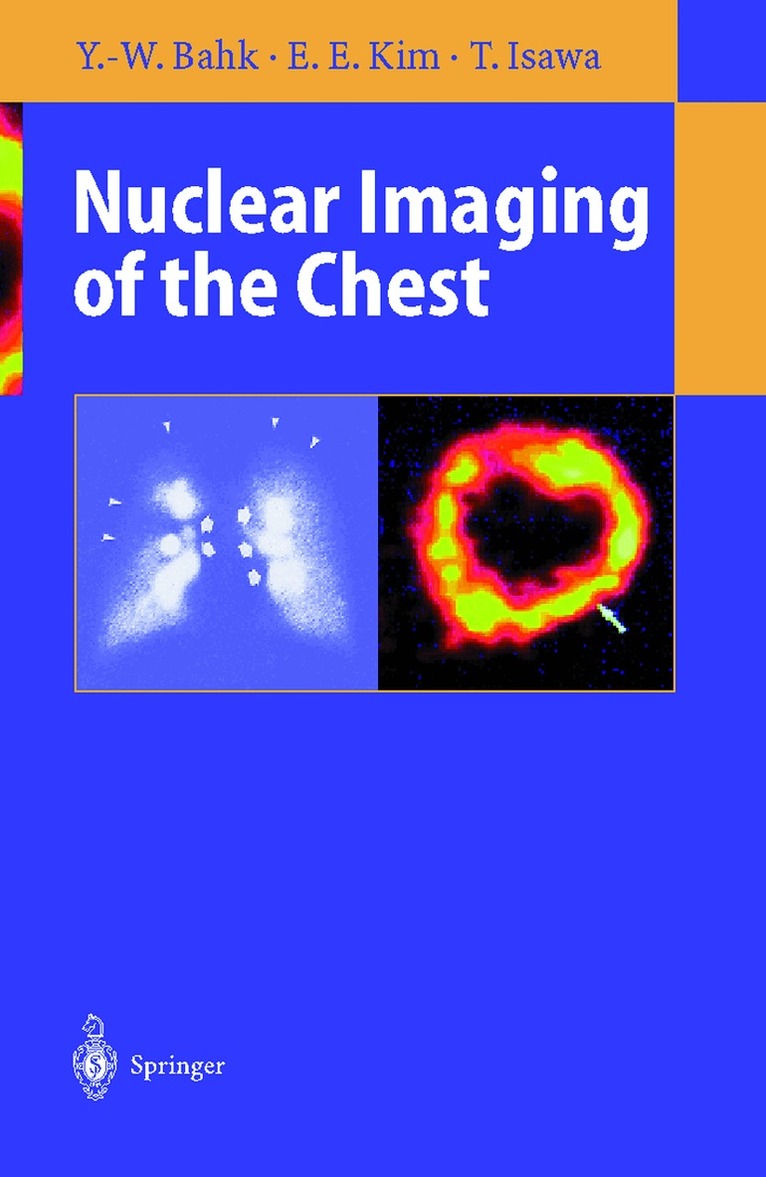 Yong-Whee Bahk, E.Edmund Kim, Toyoharu Isawa - Nuclear Imaging of the Chest, Häftad