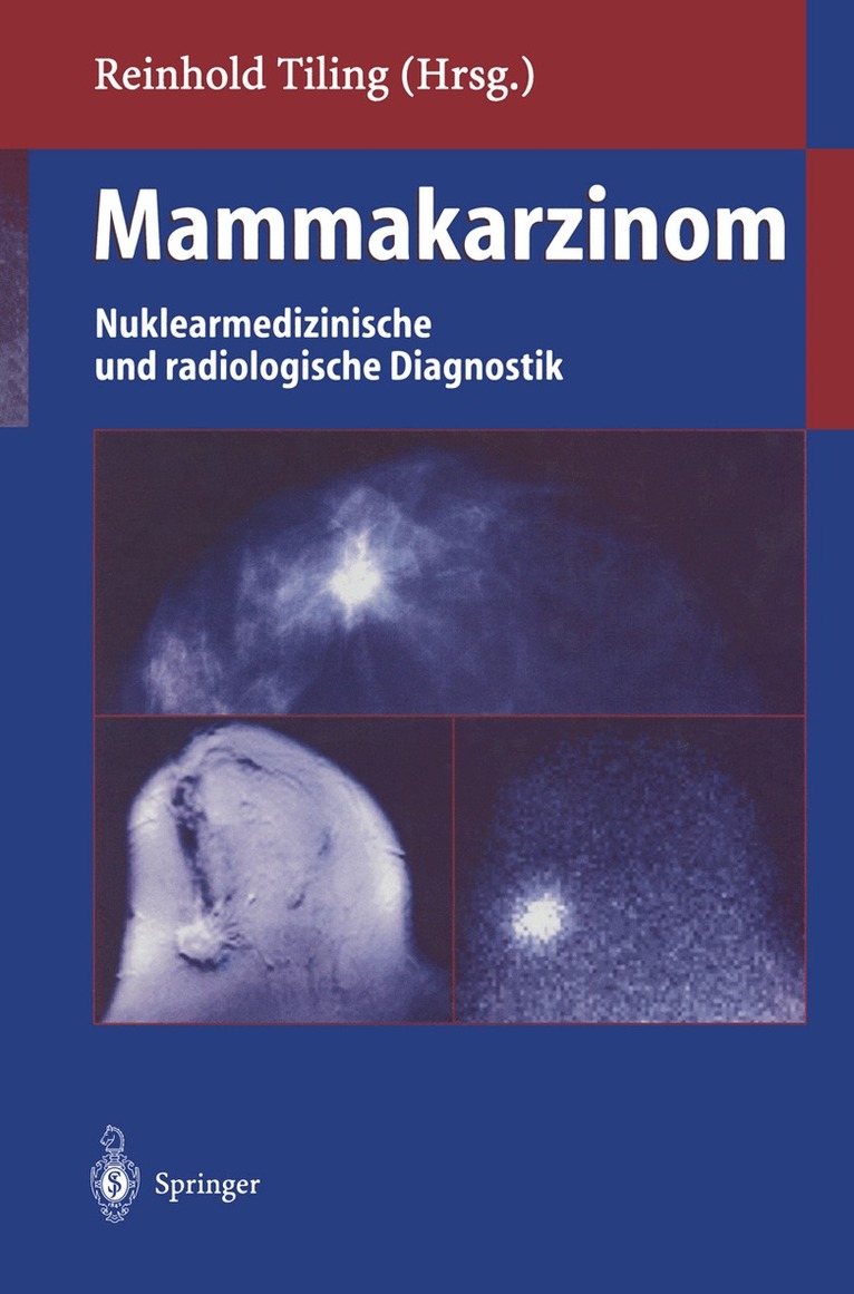 Reinhold Tiling - Mammakarzinom, Häftad. Tillgänglighet: Lägg i varukorg
