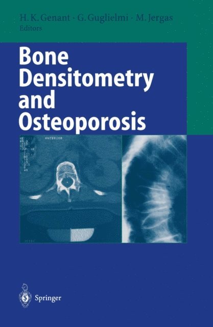 Michael Jergas, Giuseppe Guglielmi, Harry K. Genant - Bone Densitometry and Osteoporosis, E-bok