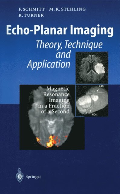 Robert Turner, Michael K. Stehling, Franz Schmitt - Echo-Planar Imaging, E-bok