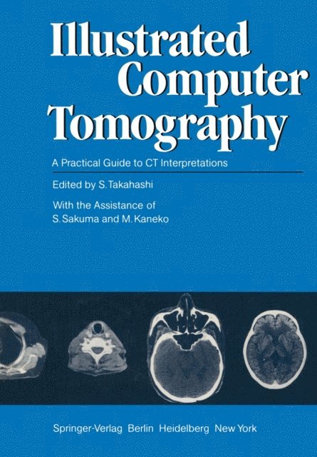 M. Kaneko, S. Sakuma, S. Takahashi - Illustrated Computer Tomography, E-bok