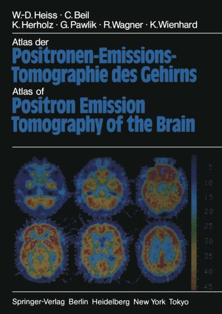K. Wienhard, G. Pawlik, R. Wagner, K. Herholz, C. Beil, W.-D. Heiss - Atlas der Positronen-Emissions-Tomographie des Gehirns / Atlas of Positron Emission Tomography of the Brain, E-bok