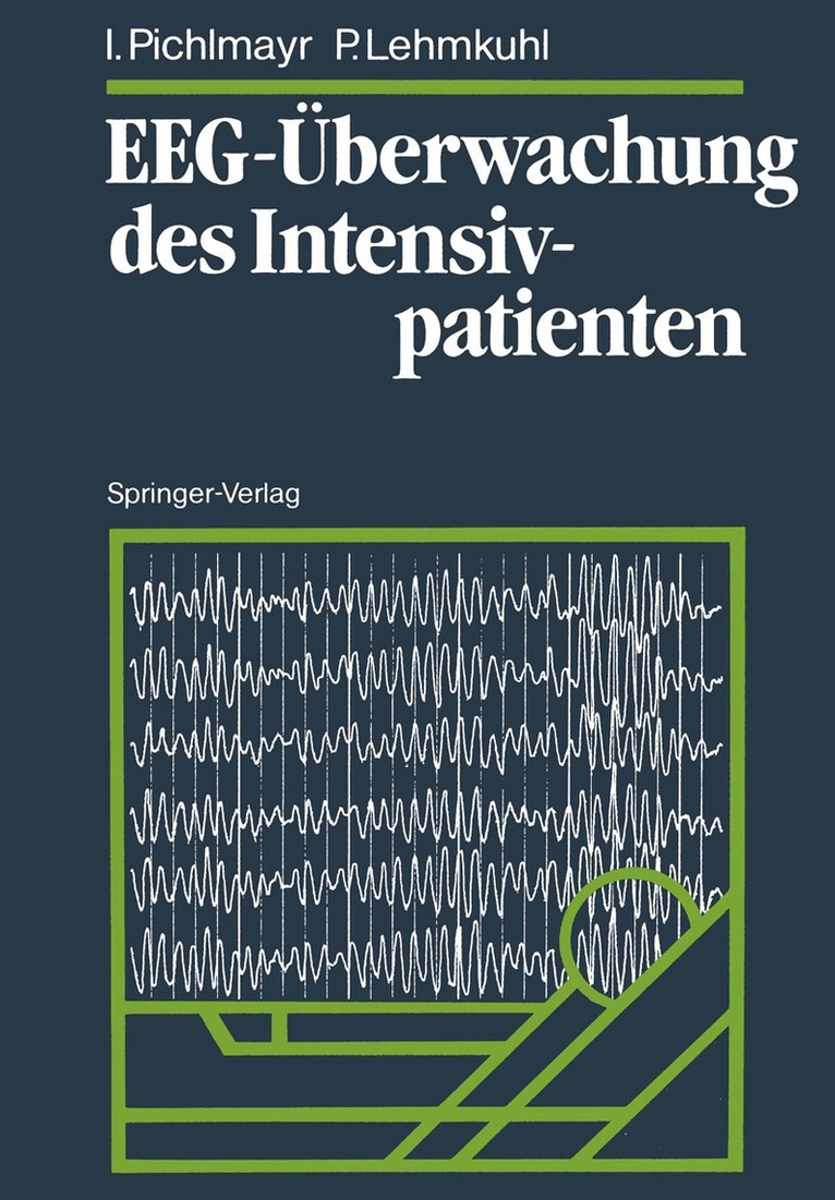 Ina Pichlmayr, Peter Lehmkuhl - EEG-Überwachung des Intensivpatienten, Häftad. Tillgänglighet: Lägg i varukorg