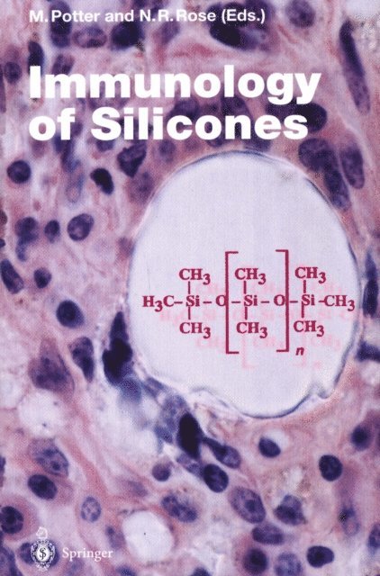 Noel Rose, Michael Potter - Immunology of Silicones, E-bok. Tillgänglighet: Lägg i varukorg
