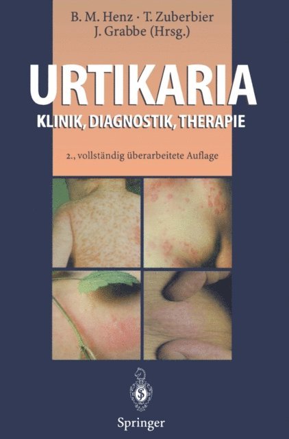Jurgen Grabbe, T. Zuberbier, Beate M. Henz - Urtikaria, E-bok