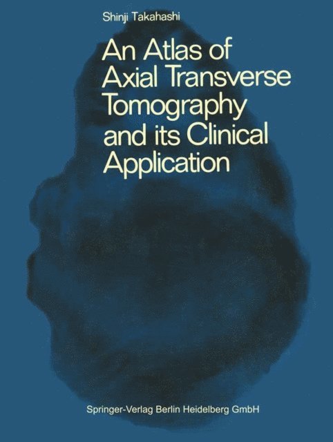 A.S. Takahashi - Atlas of Axial Transverse Tomography and its Clinical Application, E-bok
