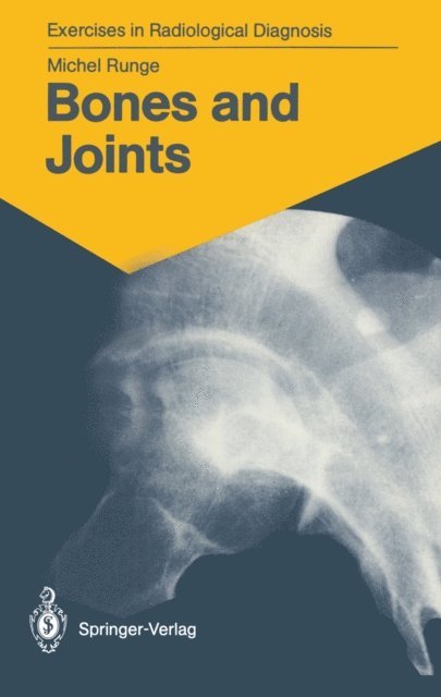Michel Runge - Bones and Joints, E-bok