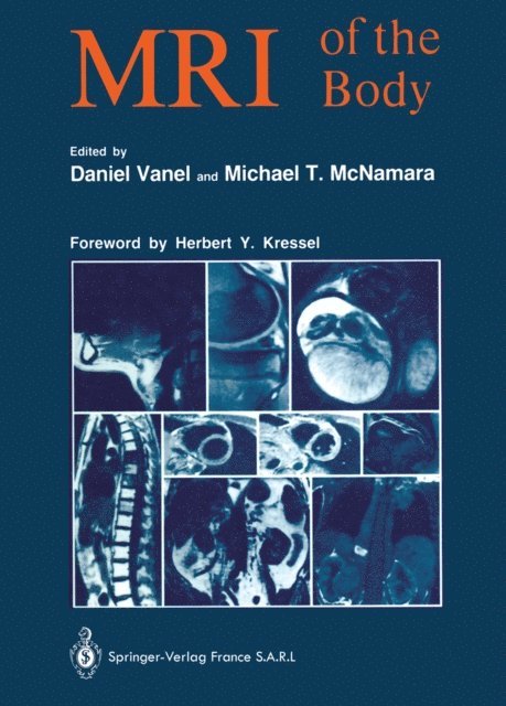 Michael T. McNamara, Daniel Vanel - MRI of the Body, E-bok