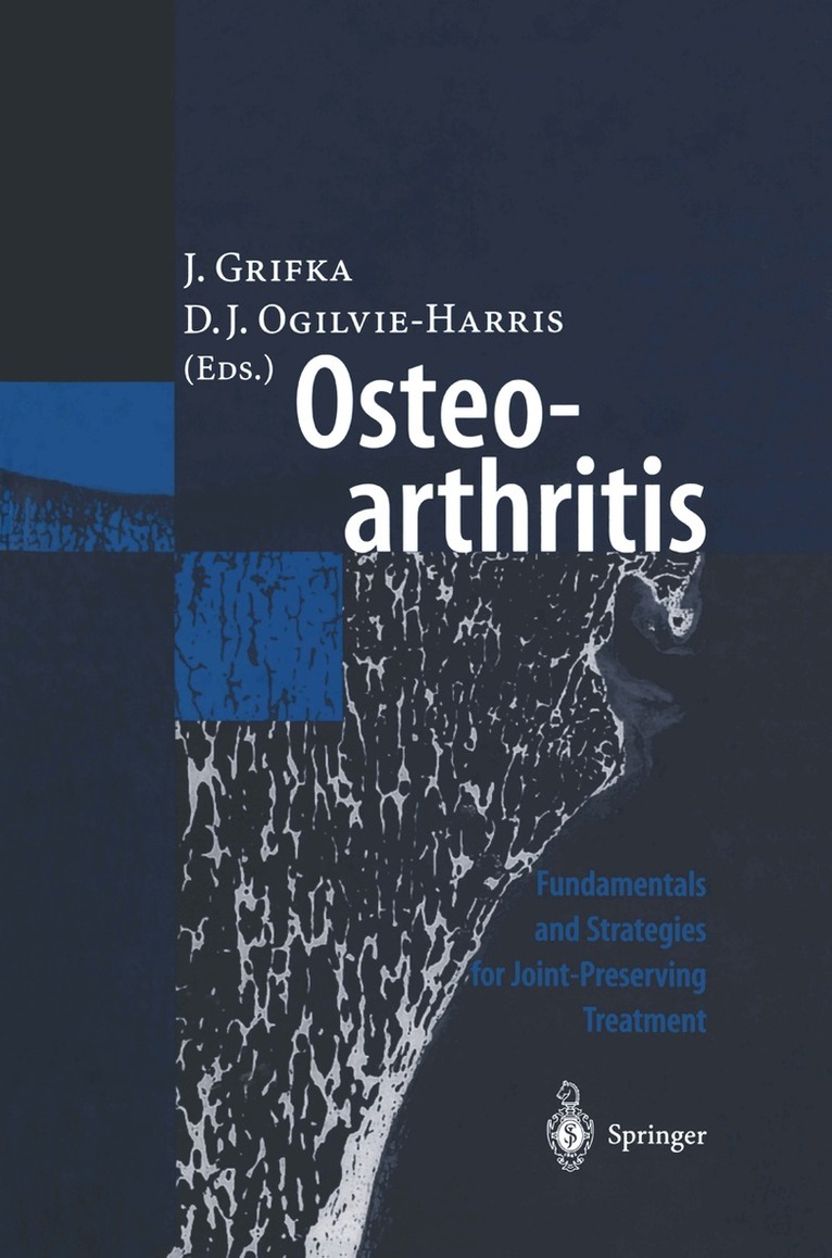 J. Grifka, D.J. Ogilvie-Harris - Osteoarthritis, Häftad