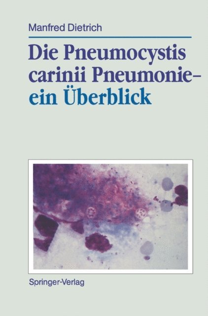 Manfred Dietrich - Die Pneumocystis carinii Pneumonie— ein Überblick, E-bok