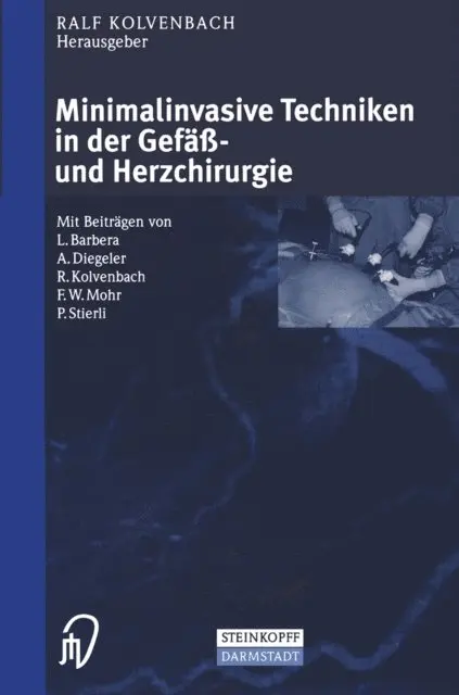 Ralf Kolvenbach - Minimalinvasive Techniken in der Gefäß- und Herzchirurgie, E-bok. Tillgänglighet: Lägg i varukorg