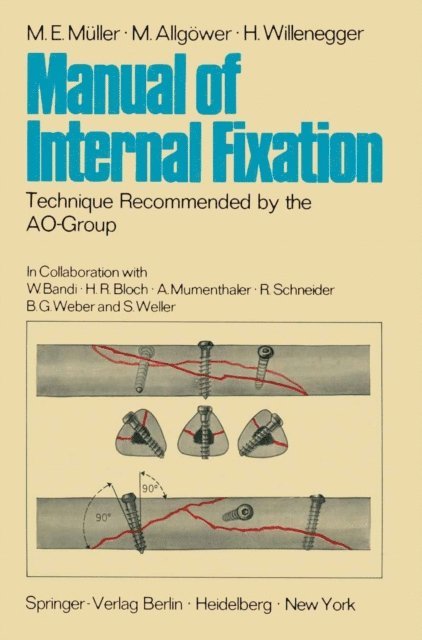 H. Willenegger, M. Allgower, M. E. Muller - Manual of Internal Fixation, E-bok