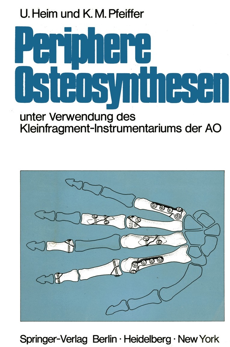 Urs Heim, Karl M. Pfeiffer - Periphere Osteosynthesen, Häftad