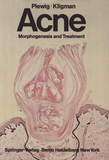 A.M. Kligman, G. Plewig - Acne, E-bok