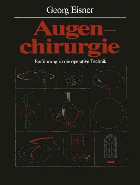 Georg Eisner - Augenchirurgie, E-bok