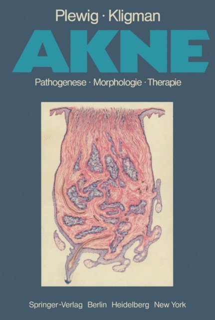 A.M. Kligman, G. Plewig - Akne, E-bok