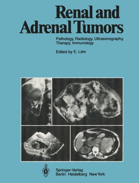 Guido Wilms, B. Swart, M.W. Strotges, C. Stambolis, E. Scherer, H.J. Richter, M. Osteaux, O. Olsson, A. Moss, P. Mellin, G. Marchal, M. Marberger, E. Lohr, L.D. Leder, J.V. Kaude, L. Jeanmart, H. Holfeld, R. Heckmann, W. Havers, R. Gunther, M. Goldberg, U. Goerttler, M. Georgi, W.A. Fuchs, V. Fiedler, H.C. Dominick, E. Boijsen, W. Bischoff, D. Beyer, H. Behrendt, A. Baert, D. Bachmann, R. Ackerman, E. Lohr - Renal and Adrenal Tumors, E-bok