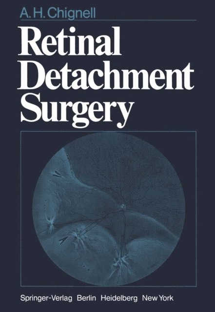 A. H. Chignell - Retinal Detachment Surgery, E-bok. Tillgänglighet: Lägg i varukorg