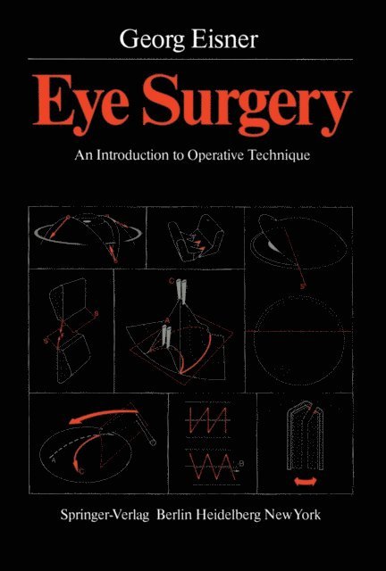 Georg Eisner - Eye Surgery, E-bok