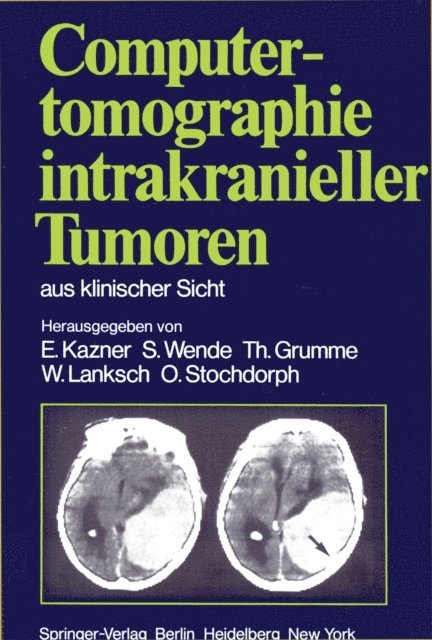 O. Stochdorph, W. Lanksch, T. Grumme, S. Wende, E. Kazner - Computertomographie intrakranieller Tumoren aus klinischer Sicht, E-bok