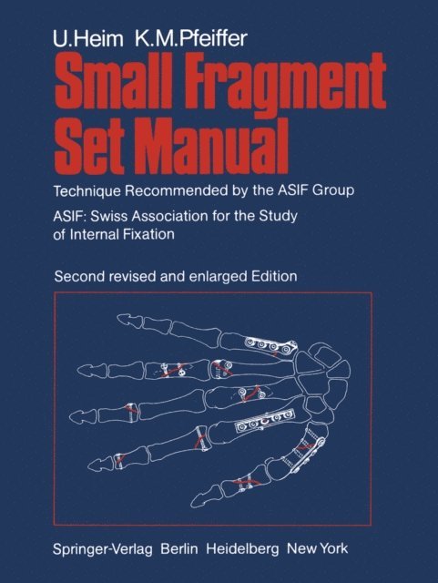 K.M. Pfeiffer, U. Heim - Small Fragment Set Manual, E-bok