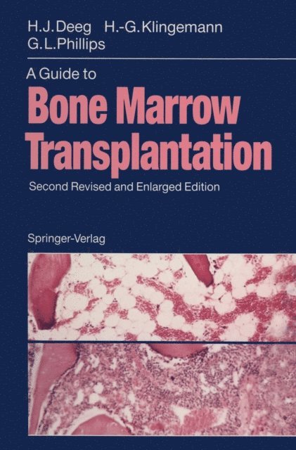 Gordon L. Phillips, Hans-Georg Klingemann, H.Joachim Deeg - Guide to Bone Marrow Transplantation, E-bok