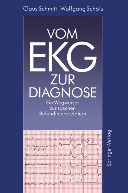 Wolfgang Schols, Claus Schmitt - Vom EKG zur Diagnose, E-bok