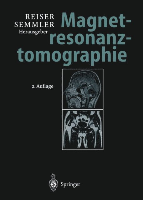 Wolfhard Semmler, Maximilian Reiser - Magnetresonanztomographie, E-bok