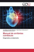 Manual de arritmias cardiacas