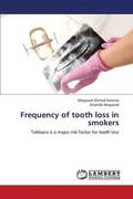 Frequency of Tooth Loss in Smokers