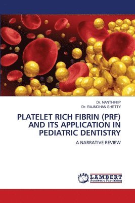 Nanthini P, Rajmohan Shetty - Platelet Rich Fibrin (Prf) and Its Application in Pediatric Dentistry, Häftad. Tillgänglighet: Lägg i varukorg