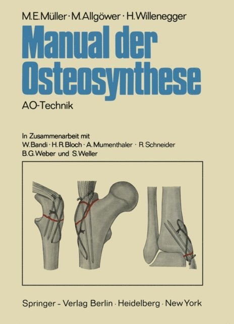 H. Willenegger, M. Allgower, M. E. Muller - Manual der Osteosynthese, E-bok