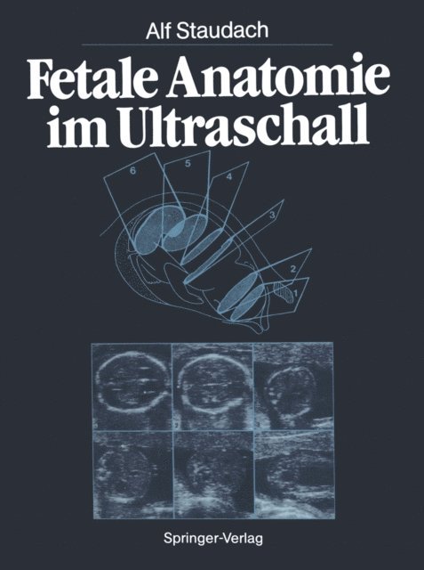 Alf Staudach - Fetale Anatomie im Ultraschall, E-bok