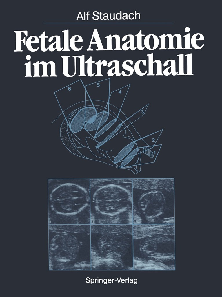 Alf Staudach - Fetale Anatomie im Ultraschall, Häftad