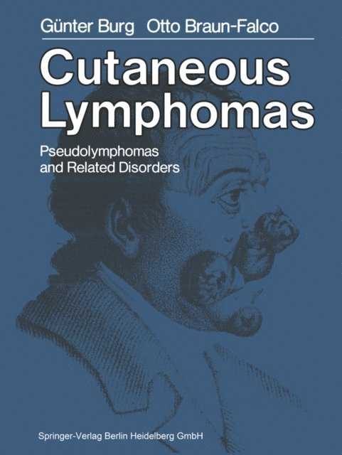 O. Braun-Falco, G. Burg - Cutaneous Lymphomas, Pseudolymphomas, and Related Disorders, E-bok
