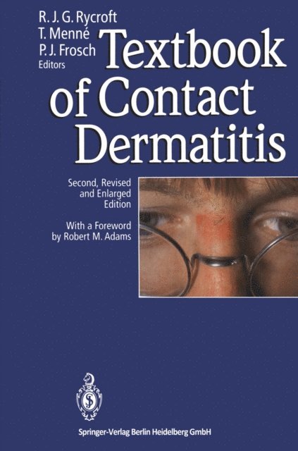 Peter J. Frosch, Torkil Menne, Richard J.G. Rycroft - Textbook of Contact Dermatitis, E-bok