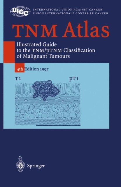 C. Wittekind, G. Wagner, L.H. Sobin, R.V.P. Hutter, P. Hermanek - TNM Atlas, E-bok
