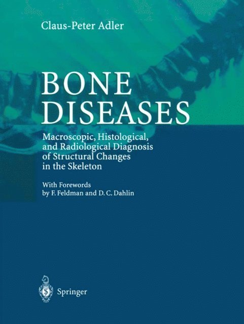 Claus-Peter Adler - Bone Diseases, E-bok