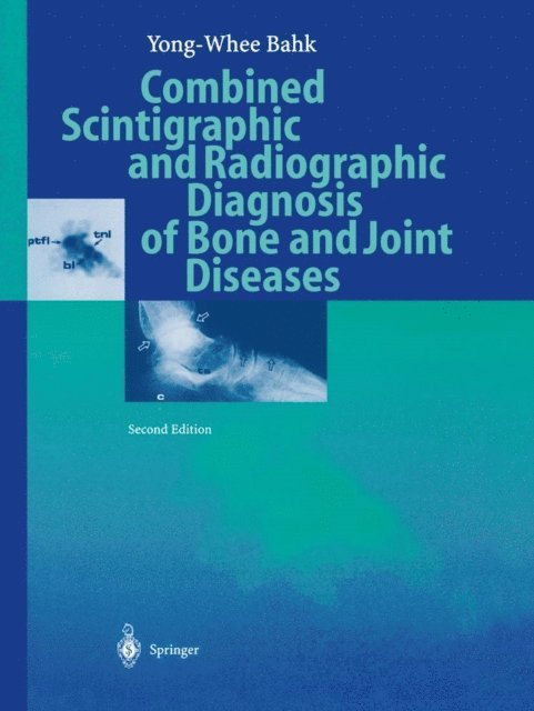 Yong-Whee Bahk - Combined Scintigraphic and Radiographic Diagnosis of Bone and Joint Diseases, E-bok