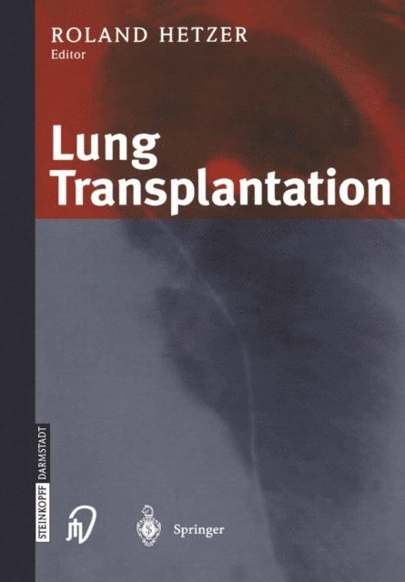 R. Hetzer - Lung Transplantation, E-bok