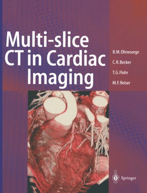 Maximilian F Reiser, Christoph R. Becker, Thomas G. Flohr, Bernd M. Ohnesorge - Multi-slice CT in Cardiac Imaging, E-bok