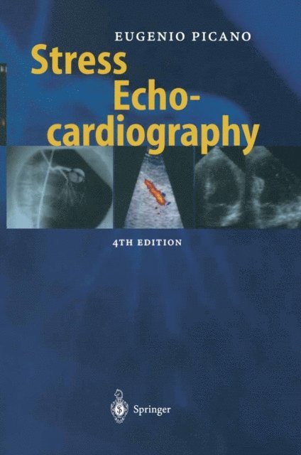 Eugenio Picano - Stress Echocardiography, E-bok. Tillgänglighet: Lägg i varukorg