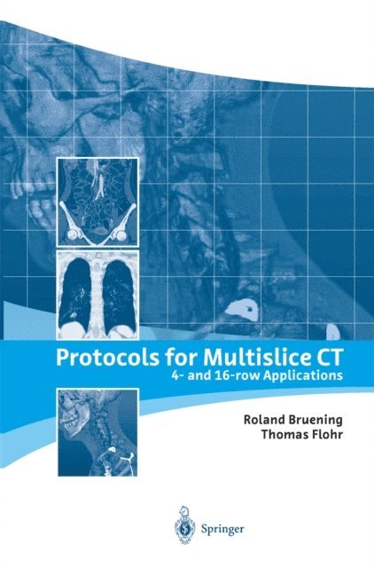 Thomas Flohr, Roland Bruening - Protocols for Multislice CT, E-bok