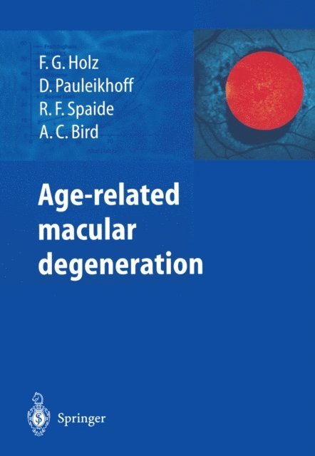 Alan C. Bird, Richard F. Spaide, Daniel Pauleikhoff, Frank G. Holz - Age-related macular degeneration, E-bok