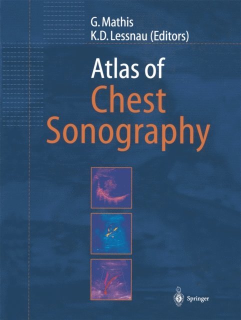 Klaus D. Lessnau, Gebhard Mathis - Atlas of Chest Sonography, E-bok
