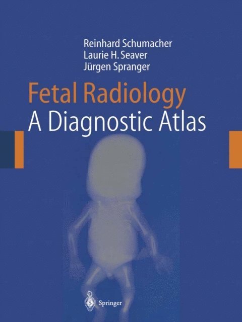 Jurgen Spranger, Laurie H. Seaver, Reinhard Schumacher - Fetal Radiology, E-bok