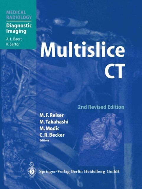 Christoph R. Becker, Michael Modic, Mutsumasa Takahashi, Maximilian F Reiser - Multislice CT, E-bok